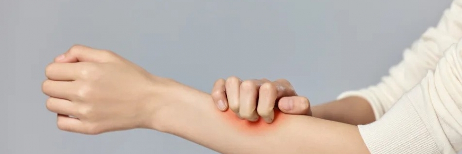 濕疹、瘙癢、蕁麻疹……患皮膚病，也許是好事！